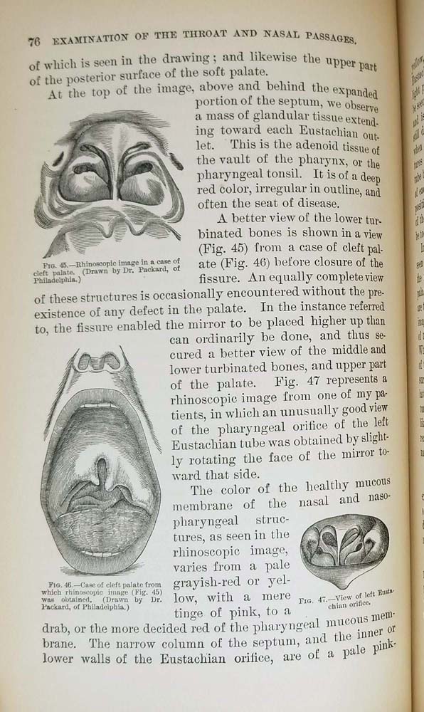 Diseases of the Throat and Nasal Passages - J. Solis Cohen 1884