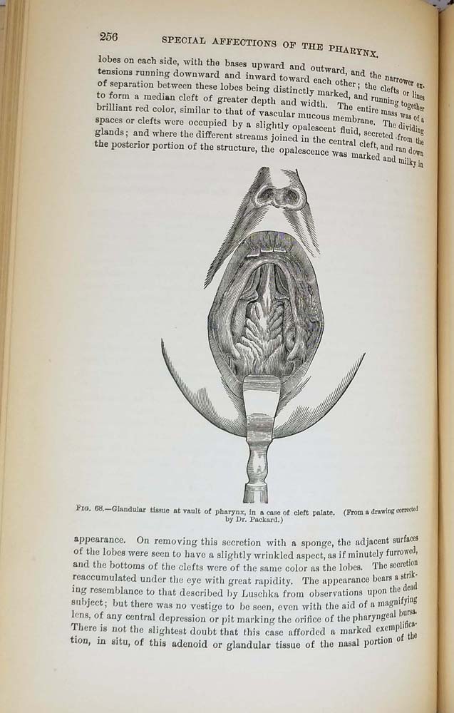 Diseases of the Throat and Nasal Passages - J. Solis Cohen 1884
