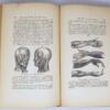 The Hydropathic Family Physician - Joel Shew 1874